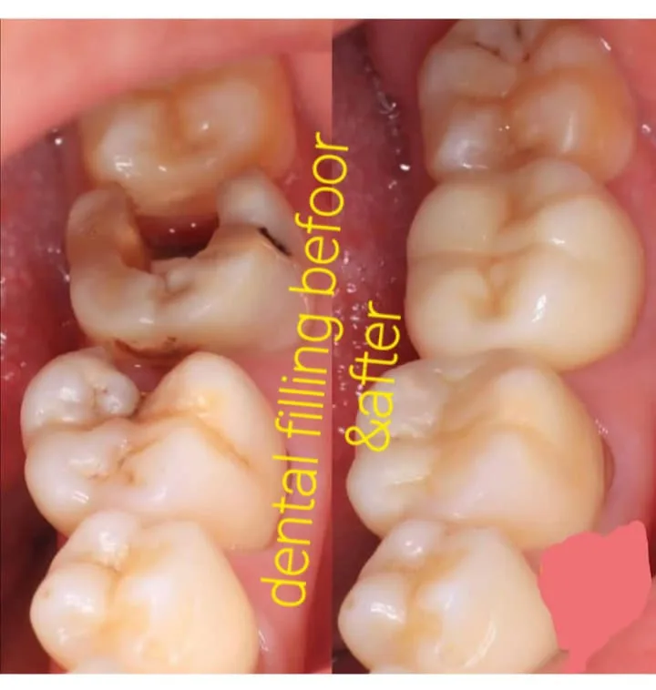 Alanya HEALTHY TEETH Dental Aesthetic — 医学 在阿兰亚: 在线订购、价格和评价