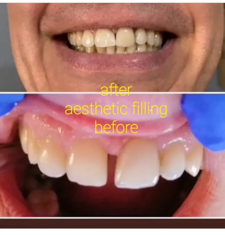 Alanya HEALTHY TEETH Dental Aesthetic — 医学 在阿兰亚: 在线订购、价格和评价