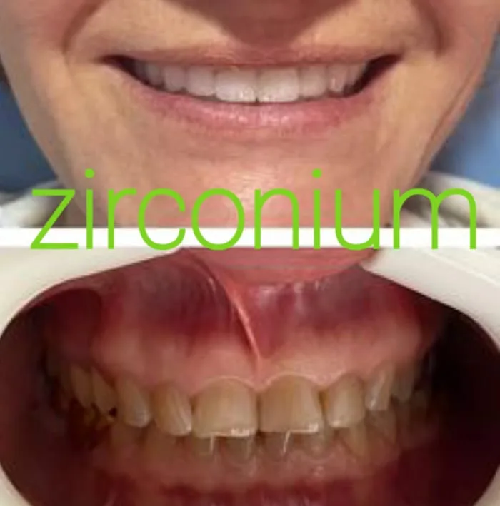 Alanya HEALTHY TEETH Dental Aesthetic — 医学 在阿兰亚: 在线订购、价格和评价