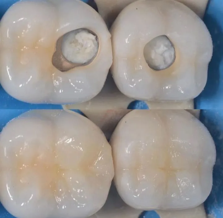 Alanya HEALTHY TEETH Dental Aesthetic — 医学 在阿兰亚: 在线订购、价格和评价