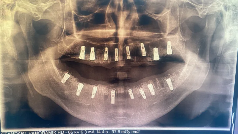 Alanya HEALTHY TEETH Dental Aesthetic — 医学 在阿兰亚: 在线订购、价格和评价