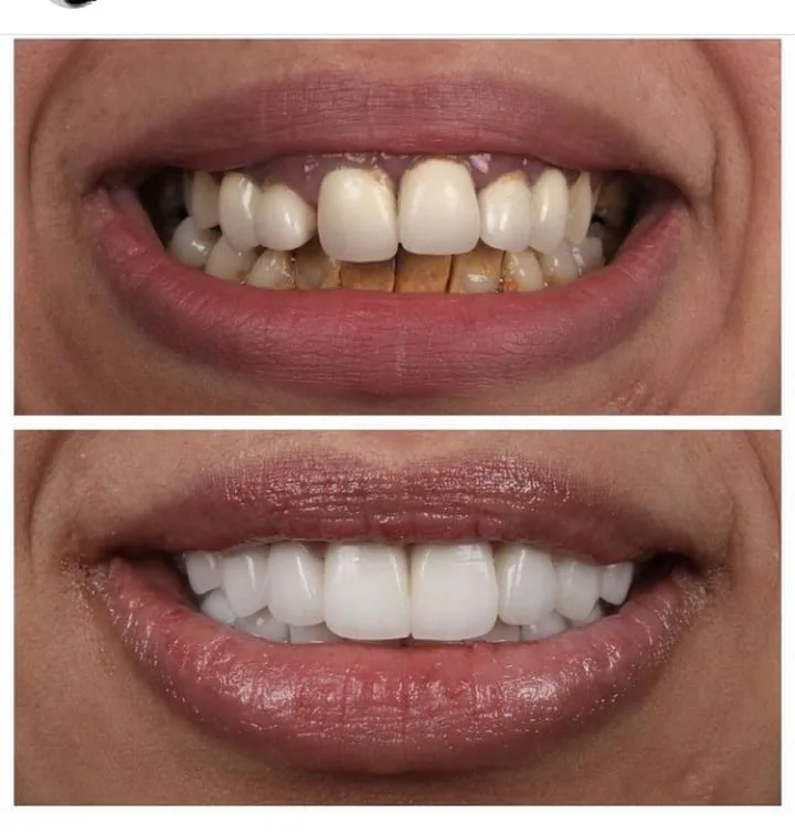 Alanya HEALTHY TEETH Dental Aesthetic — 医学 在阿兰亚: 在线订购、价格和评价