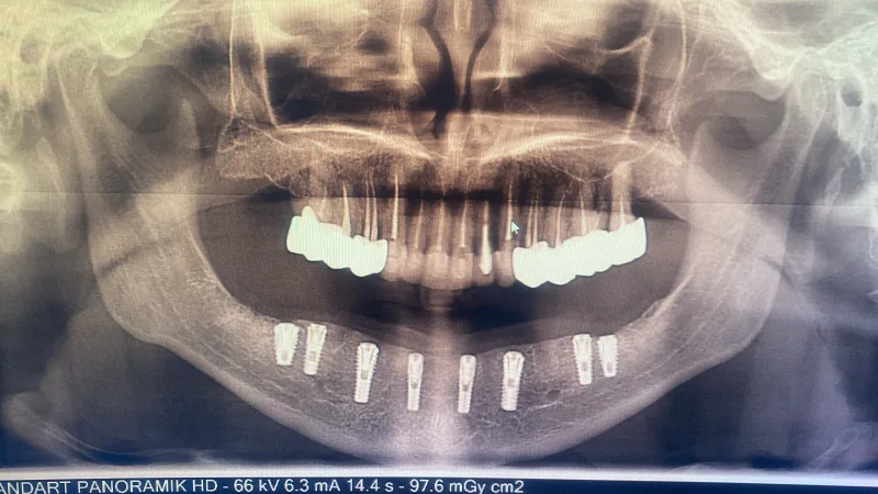 Alanya HEALTHY TEETH Dental Aesthetic — 医学 在阿兰亚: 在线订购、价格和评价