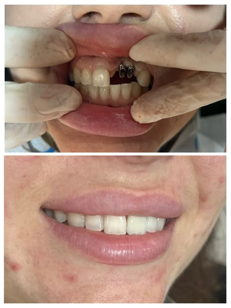 Alanya HEALTHY TEETH Dental Aesthetic — 医学 在阿兰亚: 在线订购、价格和评价