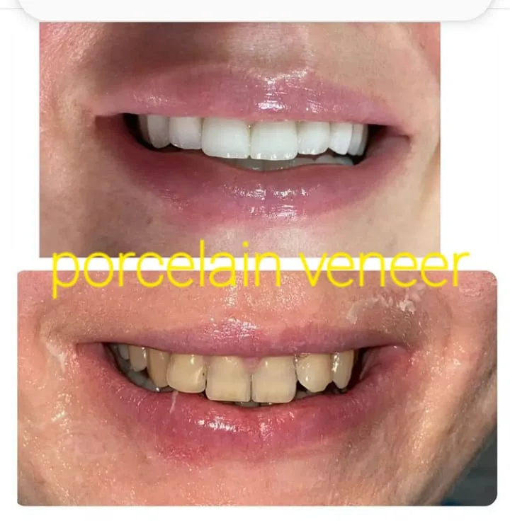 Alanya HEALTHY TEETH Dental Aesthetic — 医学 在阿兰亚: 在线订购、价格和评价