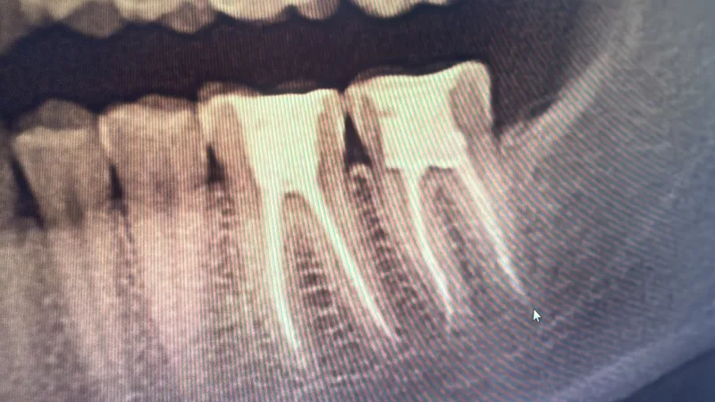 Alanya HEALTHY TEETH Dental Aesthetic — 医学 在阿兰亚: 在线订购、价格和评价
