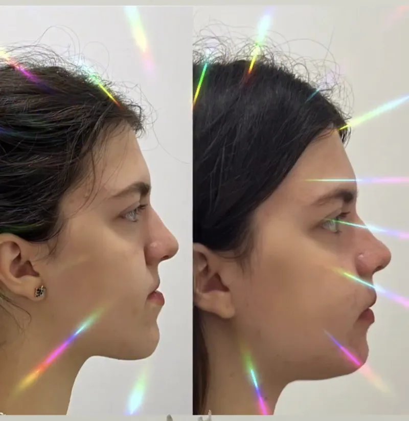 Alanya HEALTHY TEETH Dental Aesthetic — 医学 在阿兰亚: 在线订购、价格和评价